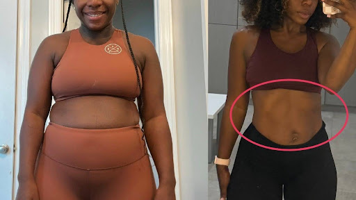 Different Symptoms. Same Woman. Connected Biology.