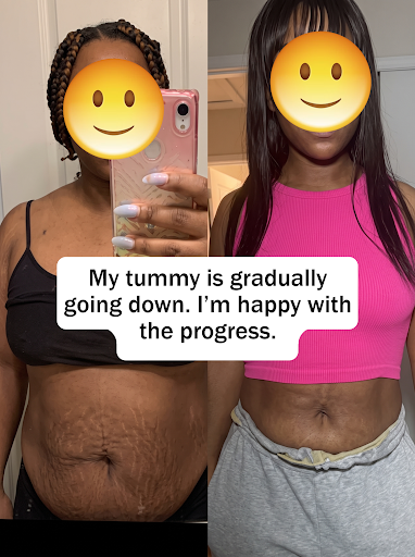 Customer Proof — Belly Transformation